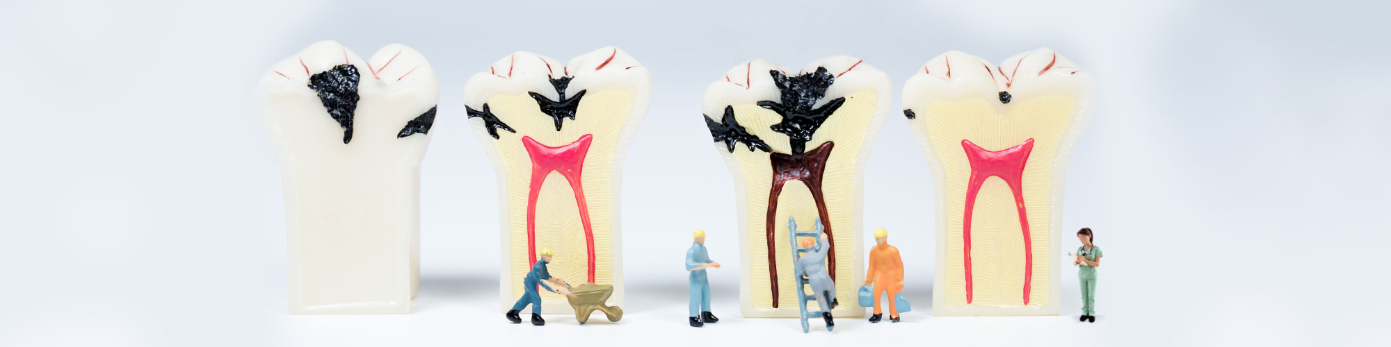 Ενδοδοντία